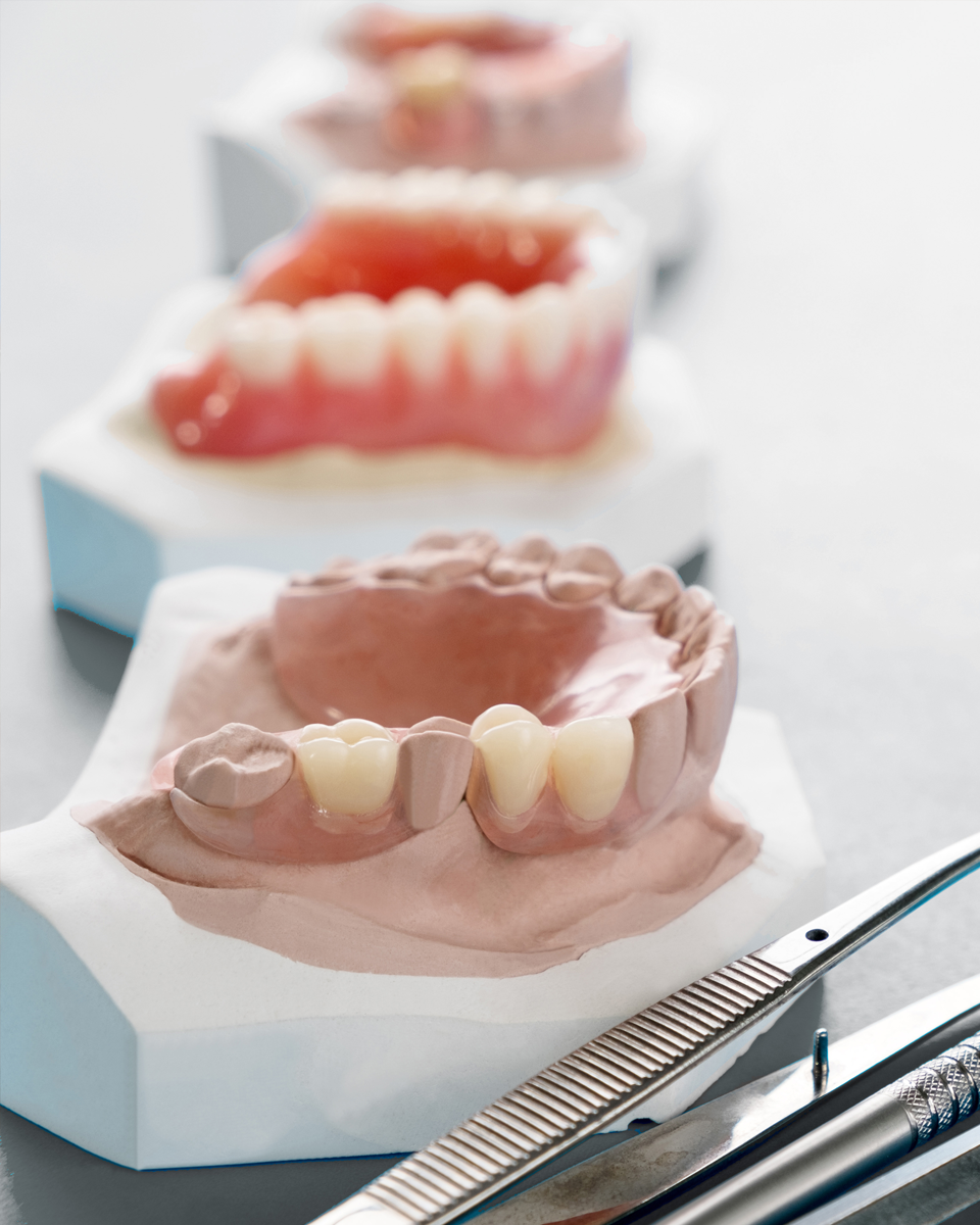 Quais são os tipos de Prótese Dentária?
